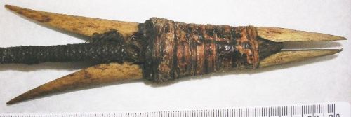 What is that organic matter between the valves? The lanyard?