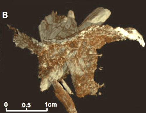 manis ct scan 3d image Waters et al 2011